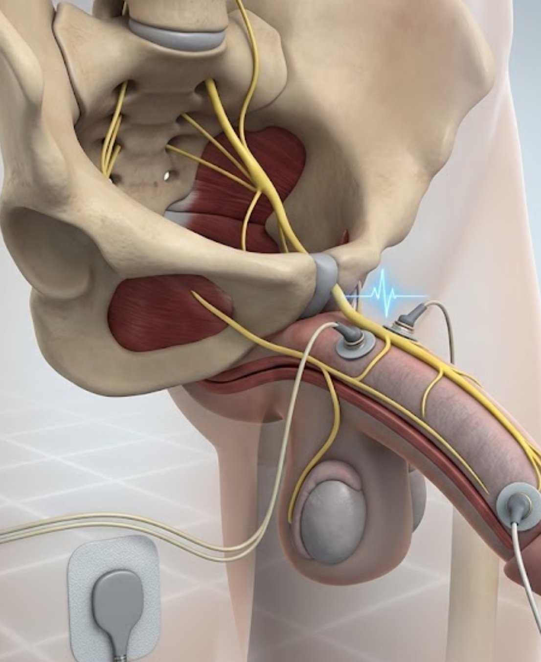 Penile sensory nerve assessment using diagnostic equipment